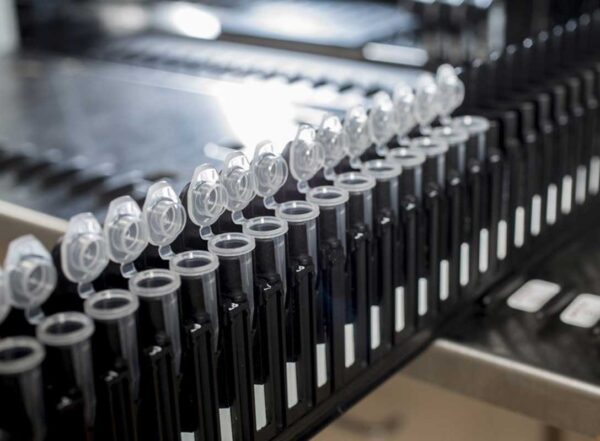 Equipment in a lab that analyzes blood samples