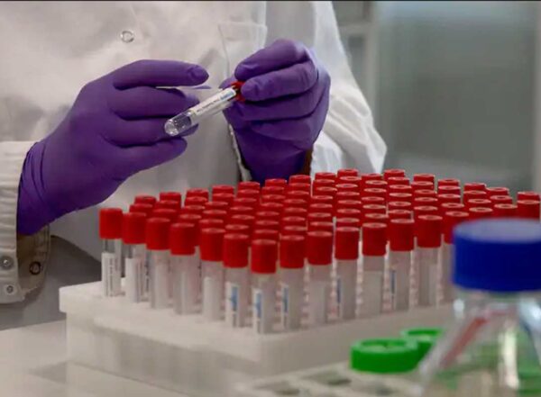 A technician labels a test tube during coronavirus research at a Belgian lab. The quest to thwart the pandemic has led to significant changes in the scientific process.