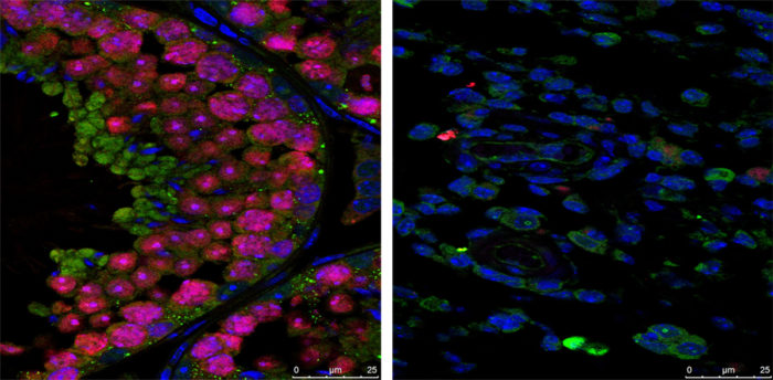 As Zika infection lingers in male mice, the internal structure of the testes breaks down. In the testes of an uninfected mouse (left), the cells appear healthy, while in the testes of an infected mouse (right), the internal structure has collapsed and few developing sperm (pink) are present.